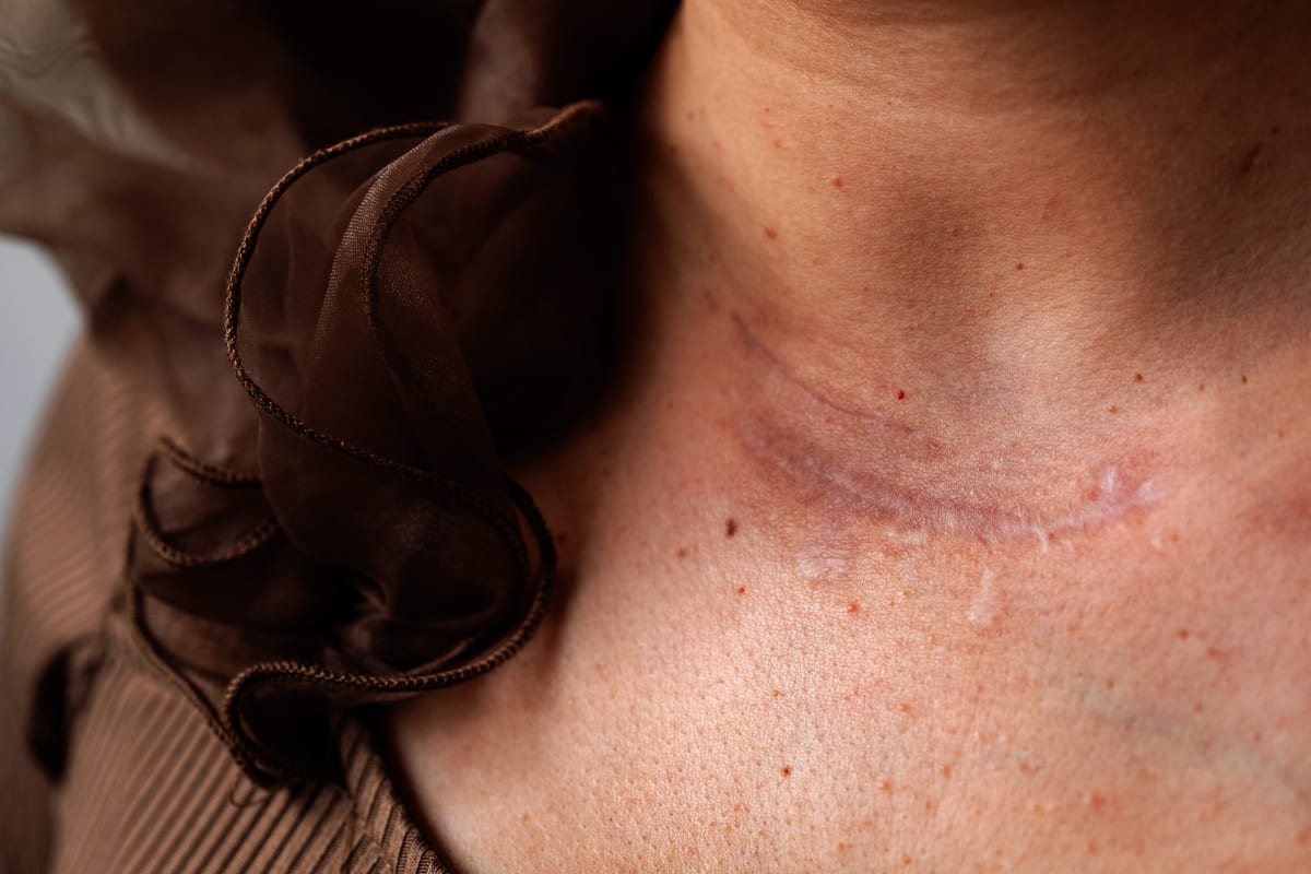 Dr Diego Loureiro - Cirurgias Reconstrutoras - Cicatrizes