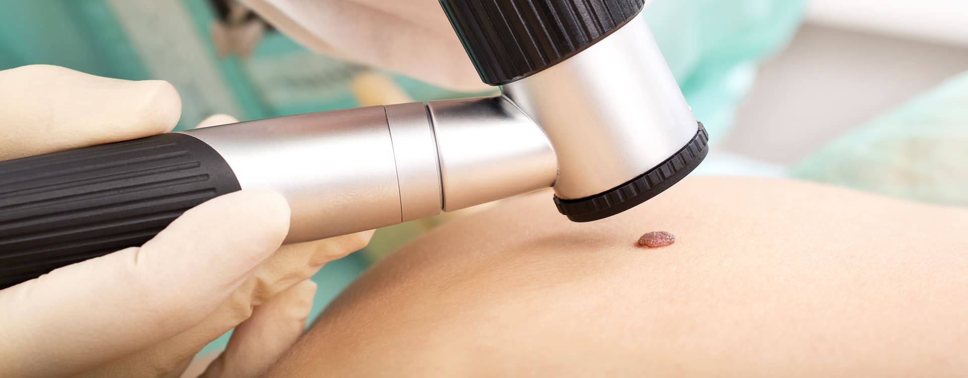 Dr Diego Loureiro - Cirurgias Reconstrutoras - Tumores Cutâneos