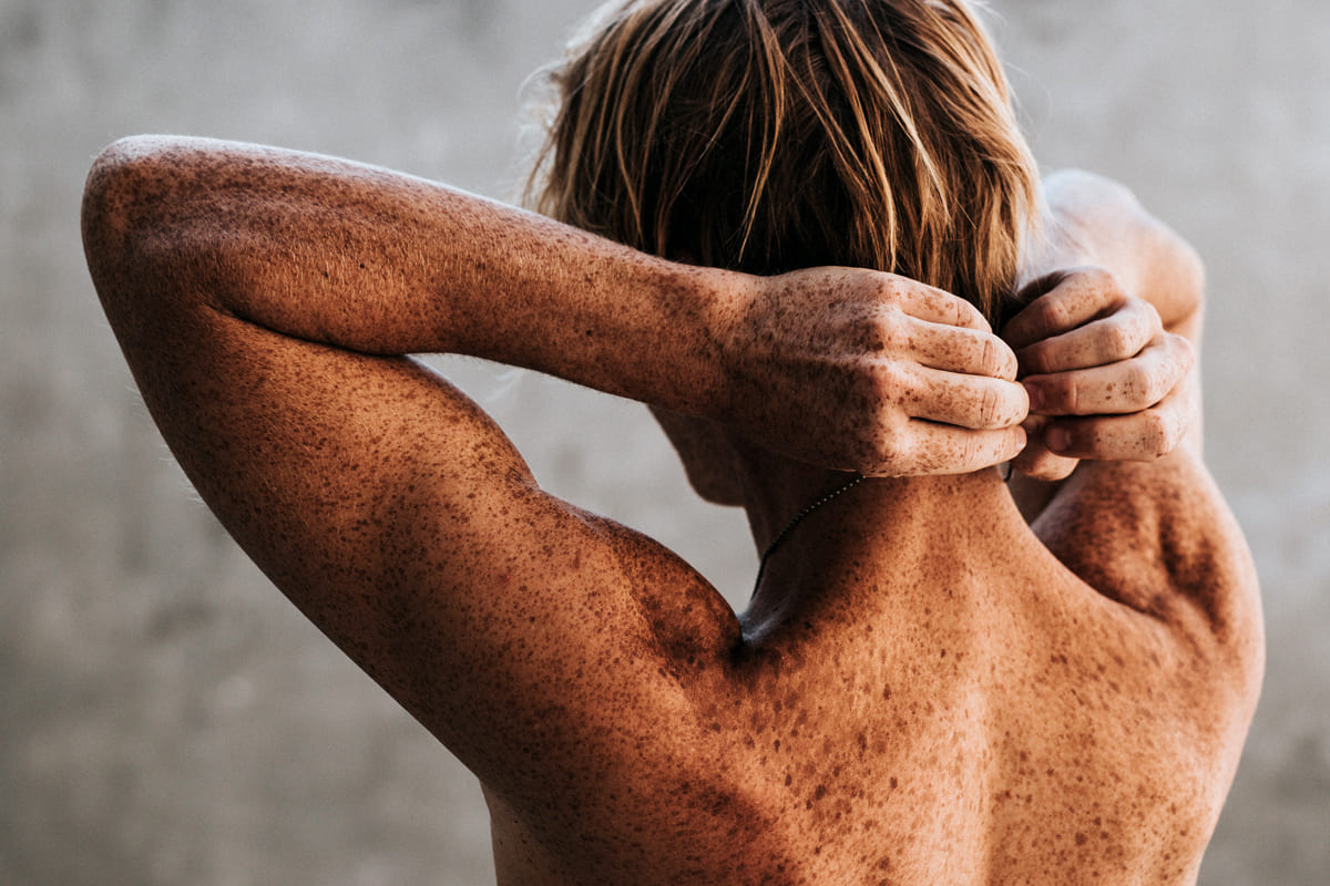 Dr Diego Loureiro - Cirurgias Reconstrutoras - Tumores Cutâneos