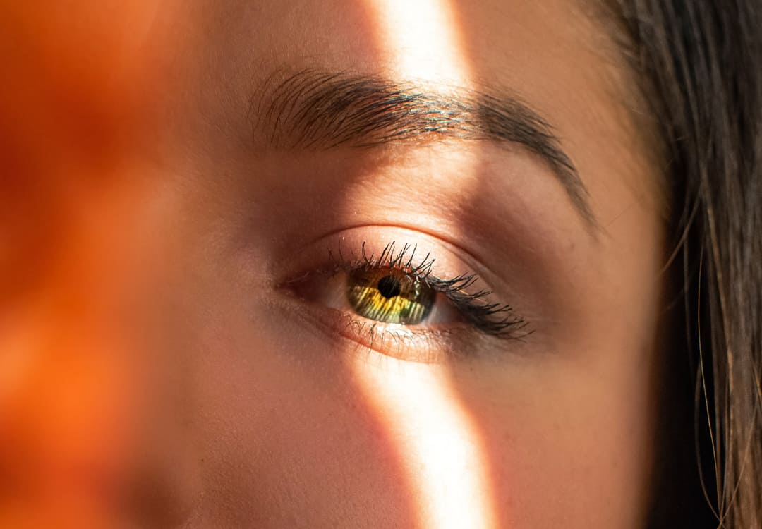 Dr Diego Loureiro - Cirurgia das pálpebras em mulheres jovens