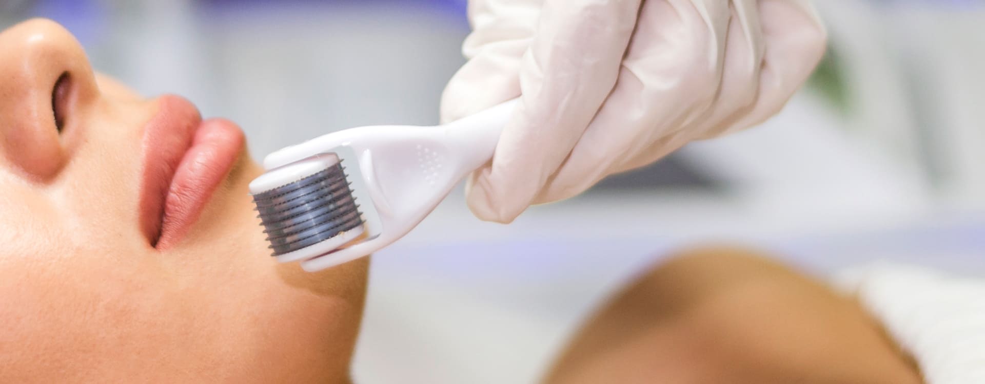 Dr Diego Loureiro - Tratamentos Faciais - Microagulhamento