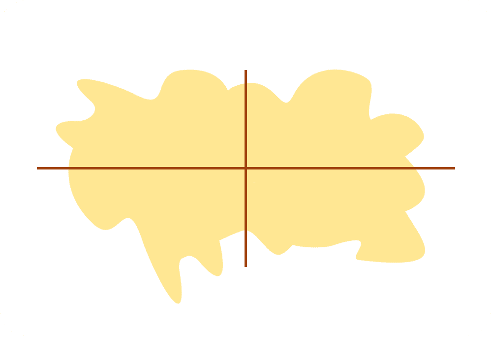 Dr Diego Loureiro - Cirurgias Reconstrutoras - Tumores da Pele - ABCDE (Assimetria)