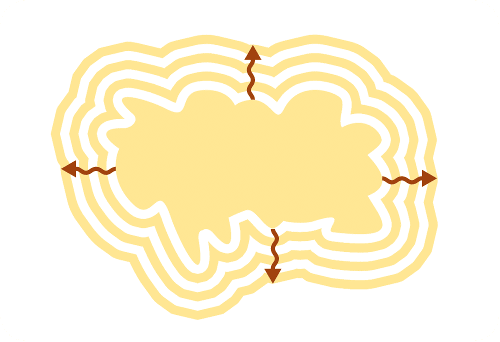 Dr Diego Loureiro - Cirurgias Reconstrutoras - Tumores da Pele - ABCDE (Evolução)